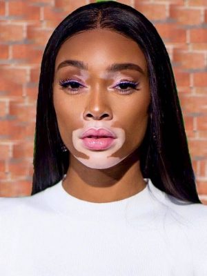 Winnie Harlow Height, Weight, Birthday, Hair Color, Eye Color